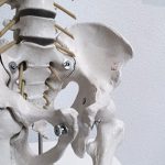 spit hernia skelet onderrug